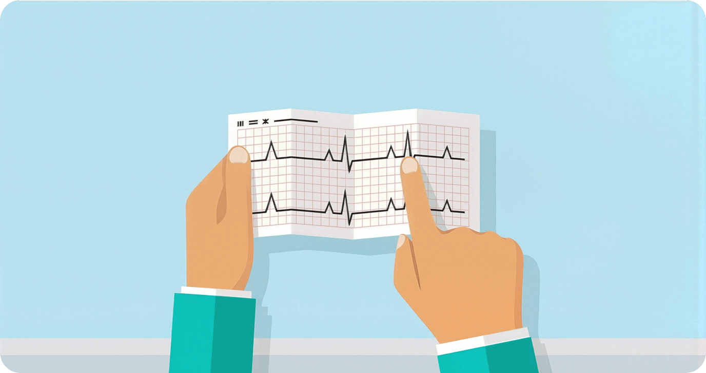 Риск инсульта | Geropharm-trends.ru